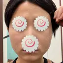 脂肪溶解注射（顔） 聖心美容クリニック 福岡院 BEFORE サムネイル用