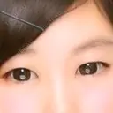 二重埋没 品川美容外科 静岡院 BEFORE サムネイル用