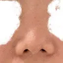 隆鼻術 / 軟骨移植 フェアクリニック川口 BEFORE サムネイル用