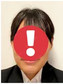 骨切り（あご） / 骨削り（エラ） リラ・クラニオフェイシャル・クリニック BEFORE サムネイル用
