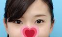 二重切開 / 上まぶたの脂肪取り id（アイディ）美容外科 BEFORE サムネイル用