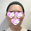 脂肪吸引（顔） / 切開リフト / PRP皮膚再生療法 湘南美容クリニック 新宿本院 BEFORE サムネイル用