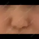 その他 TCB東京中央美容外科 新横浜院 BEFORE サムネイル用