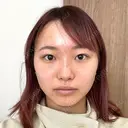 目頭切開 / タレ目形成・グラマラスライン（切開） / 口角挙上 / ボトックス（あご） / その他（口元） 東京形成美容外科 船橋院 BEFORE サムネイル用