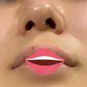 人中短縮 eクリニック 金沢本院 BEFORE サムネイル用