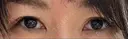 眉下切開 松下皮フ形成外科 BEFORE サムネイル用