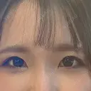 目頭切開 eクリニック 金沢本院 BEFORE サムネイル用