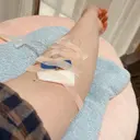 美容点滴・美容注射（ダイエット） TOKYO ACE CLINIC 心斎橋院 BEFORE サムネイル用