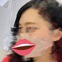 ヒアルロン酸注入（額） MSC LUNA CLINIC 渋谷院 BEFORE サムネイル用