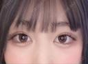 ヒアルロン酸注入（涙袋） フィラークリニック 名古屋栄院 BEFORE サムネイル用
