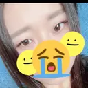 二重埋没 大塚美容形成外科 札幌院 BEFORE サムネイル用