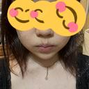 糸リフト / バッカルファット除去 / 脂肪吸引（顔） / ボトックス（エラ・小顔） アリエル美容クリニック 大宮院 BEFORE サムネイル用