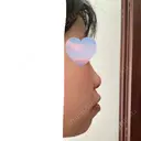 鼻尖形成（切開） Olino美容外科・美容皮膚科 BEFORE サムネイル用