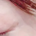 アートメイク（ほくろ） oneUPclinic BEFORE サムネイル用