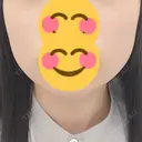 ボトックス（エラ・小顔） TCB東京中央美容外科 高崎院 BEFORE サムネイル用
