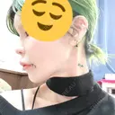鼻尖形成（非切開） / 鼻中隔延長（非切開） ルラ美容クリニック銀座院 BEFORE サムネイル用