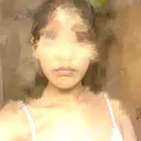 骨切り（あご） / 脂肪吸引（顔） 銀座マイアミ美容外科 BEFORE サムネイル用