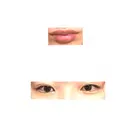 ヒアルロン酸注入（涙袋） / ヒアルロン酸注入（唇） 銀座美容外科クリニック 新宿院 BEFORE サムネイル用