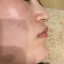 ポテンツァ レナータクリニック 立川院 BEFORE サムネイル用