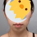 ボトックス（あご） / ヒアルロン酸注入（あご） フローラクリニック BEFORE サムネイル用