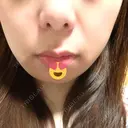 人中短縮 心斎橋中央クリニック BEFORE サムネイル用