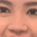 鼻尖形成（切開） / 鼻中隔延長（切開） / 鼻尖縮小 / 鼻柱下降・鼻唇角形成（猫手術） KAUNIS CLINIC（カウニスクリニック） BEFORE サムネイル用