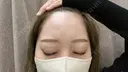 ヒアルロン酸注入（額） / ヒアルロン酸注入（こめかみ） 渋谷美容外科クリニック 新宿院 BEFORE サムネイル用