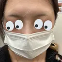 アートメイク（眉） TRUE DESIGN CLINIC BEFORE サムネイル用