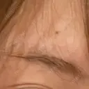 その他（目元） TRUE DESIGN CLINIC BEFORE サムネイル用