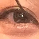 アートメイク（ほくろ） oneUPclinic BEFORE サムネイル用