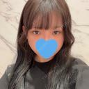 目頭切開 / クマ治療 / タレ目形成・グラマラスライン（切開） HAAB×DREAM BEAUTY CLINIC 大阪梅田院 BEFORE サムネイル用