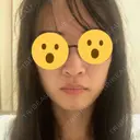 鼻尖形成（切開） / 鼻中隔延長（切開） / 小鼻縮小（切開） / 軟骨移植 / 骨切幅寄せ / ワシ鼻修正・ハンプ切除 / 鼻尖縮小 HANABI整形外科 BEFORE サムネイル用