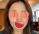 隆鼻術 / 鼻尖形成（切開） / 鼻中隔延長（切開） エースクリニック 名古屋院 BEFORE サムネイル用