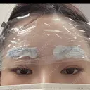 アートメイク（眉） TRUE DESIGN CLINIC BEFORE サムネイル用