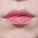 ヒアルロン酸注入（唇） TCB東京中央美容外科 梅田茶屋町院 BEFORE サムネイル用