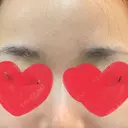 アートメイク（眉） メディカルアートメイク大阪 BEFORE サムネイル用