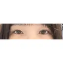 二重埋没 / 目頭切開 TCB東京中央美容外科 神戸院 BEFORE サムネイル用