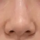 その他（鼻） / 軟骨移植 / 鼻尖形成（非切開） WOM CLINIC GINZA （ワム クリニック ギンザ） BEFORE サムネイル用