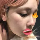 毛穴洗浄（ハイドラフェイシャルなど） / ピーリング（ハリ・ツヤ） / ミラノリピール Casa de GRACIA GINZA 【カーサデグラシアギンザ】 BEFORE サムネイル用