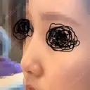 隆鼻術 / 鼻尖縮小 エースクリニック 名古屋院 BEFORE サムネイル用