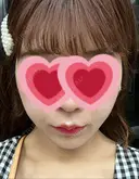 インディバ（顔） WOM SALON【術後ケア取扱いサロン】 BEFORE サムネイル用