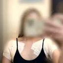 ワキ汗治療（切開） / ヒアルロン酸注入（涙袋） / ヒアルロン酸注入（額） 石倉クリニック 水戸院 BEFORE サムネイル用