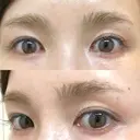 アートメイク（眉） ハナビューティークリニック BEFORE サムネイル用