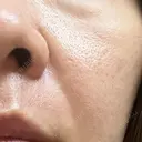 ポテンツァ GAYA body design clinic BEFORE サムネイル用