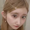 小鼻縮小（非切開） / ヒアルロン酸注入（涙袋） / ヒアルロン酸注入（鼻） / ボトックス（あご） / ヒアルロン酸注入（あご） / ボトックス（エラ・小顔） / 脂肪溶解注射（顔） / ヒアルロン酸注入（唇） / ボトックス（口角） / ヒアルロン酸注入（頬） / ヒアルロン酸注入（こめかみ） / その他（鼻） フィラークリニック 新宿院 BEFORE サムネイル用