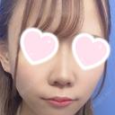 隆鼻術 / 鼻尖形成（切開） / 小鼻縮小（切開） / 軟骨移植 ASTRA BEAUTY CLINIC BEFORE サムネイル用