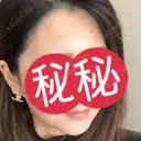 ボトックス（エラ・小顔） / ボトックス（眉間） TCB東京中央美容外科 神戸院 BEFORE サムネイル用