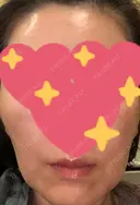 ポテンツァ ルラ美容クリニック 渋谷本院 BEFORE サムネイル用