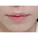 ヒアルロン酸注入（唇） あじまビューティークリニック BEFORE サムネイル用