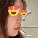 ヒアルロン酸注入（鼻） HAAB×DREAM BEAUTY CLINIC 東京本院 BEFORE サムネイル用